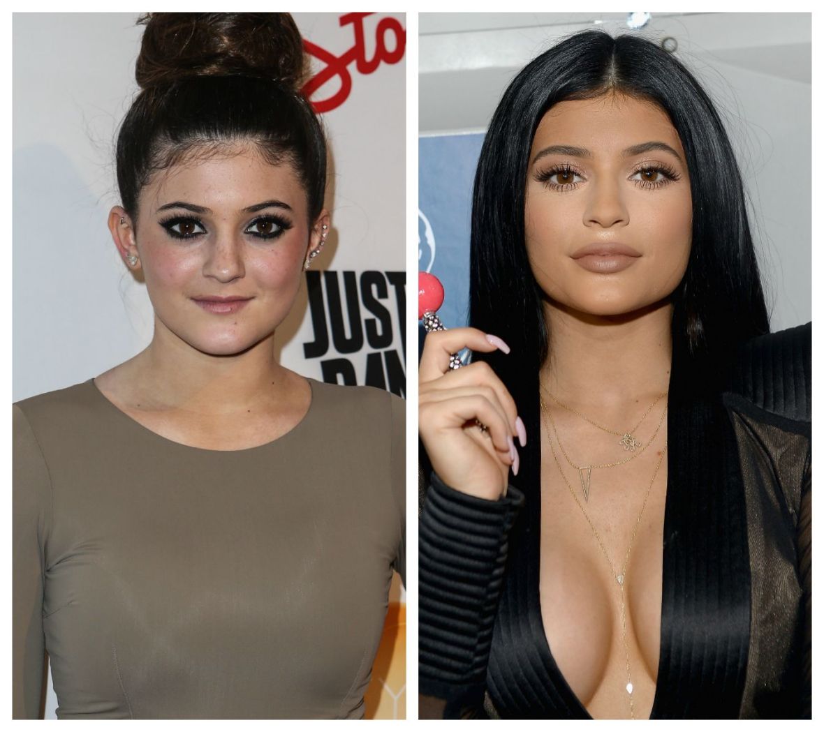 Plastic Surgery Bombshell Kylie Jenners Sisters Stage An Intervention Report In Touch Weekly 