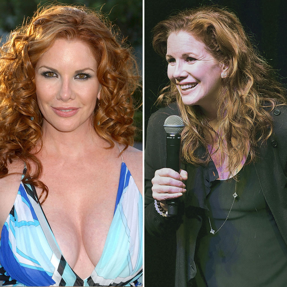 Celebrities Who Removed Their Breast Implants— Before And After Pics
