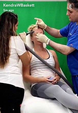 kendra wilkinson botox snapchat