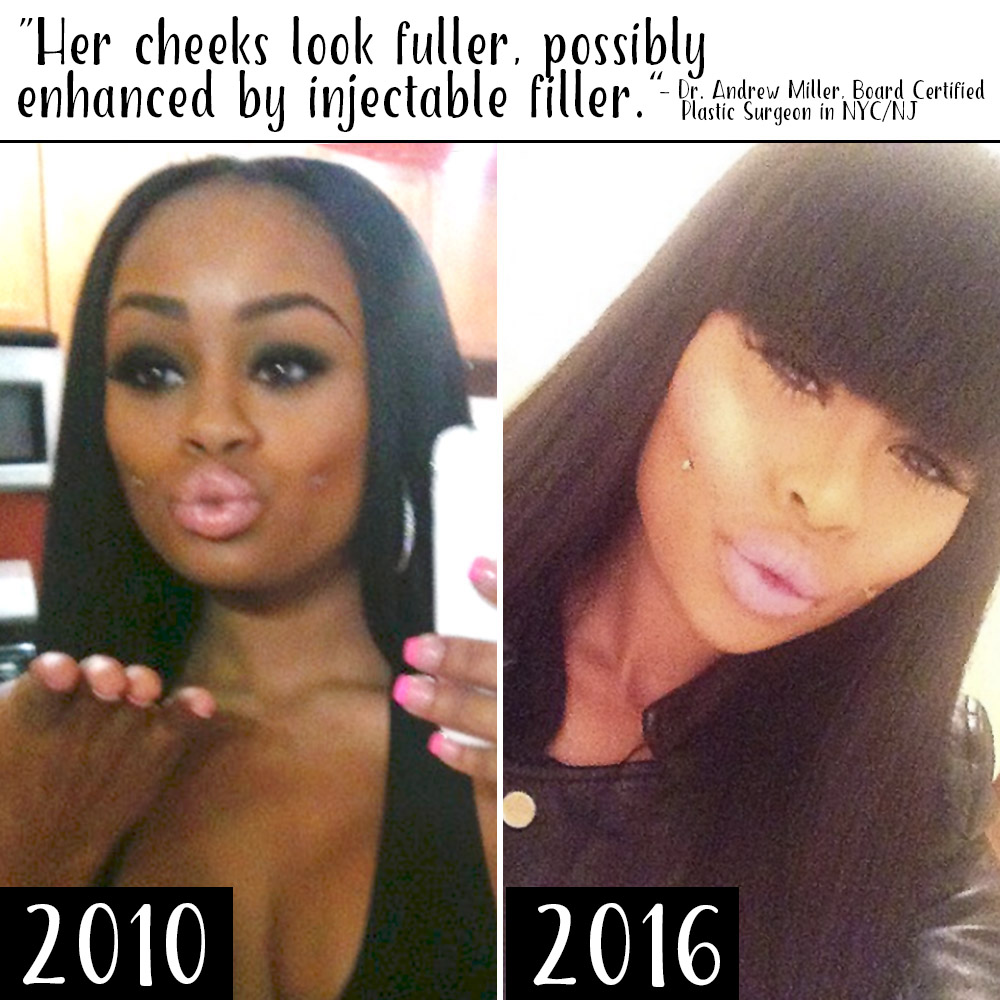 Plastic Surgery See Blac Chyna S Body Change Over Time