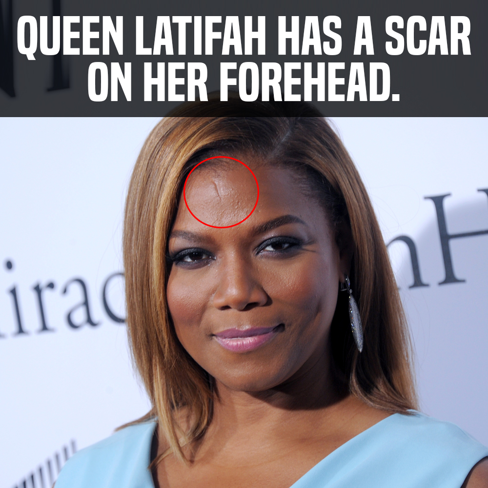 Queen latifah facial falws