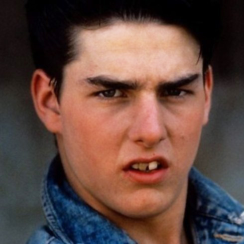 tom cruise pre-dental work