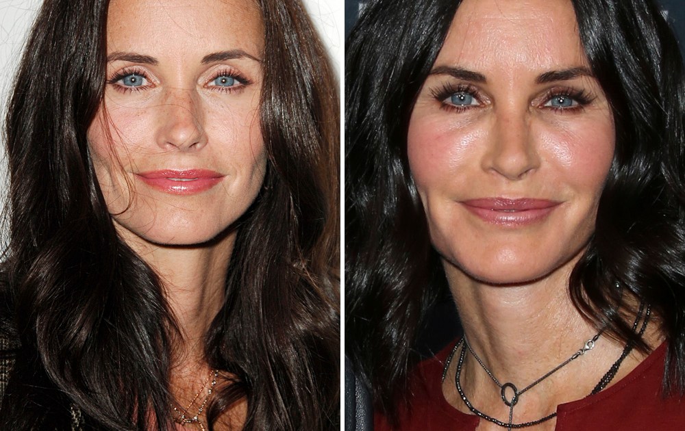 Celebrities With Plastic Surgery Heidi Montag Courteney Cox And More