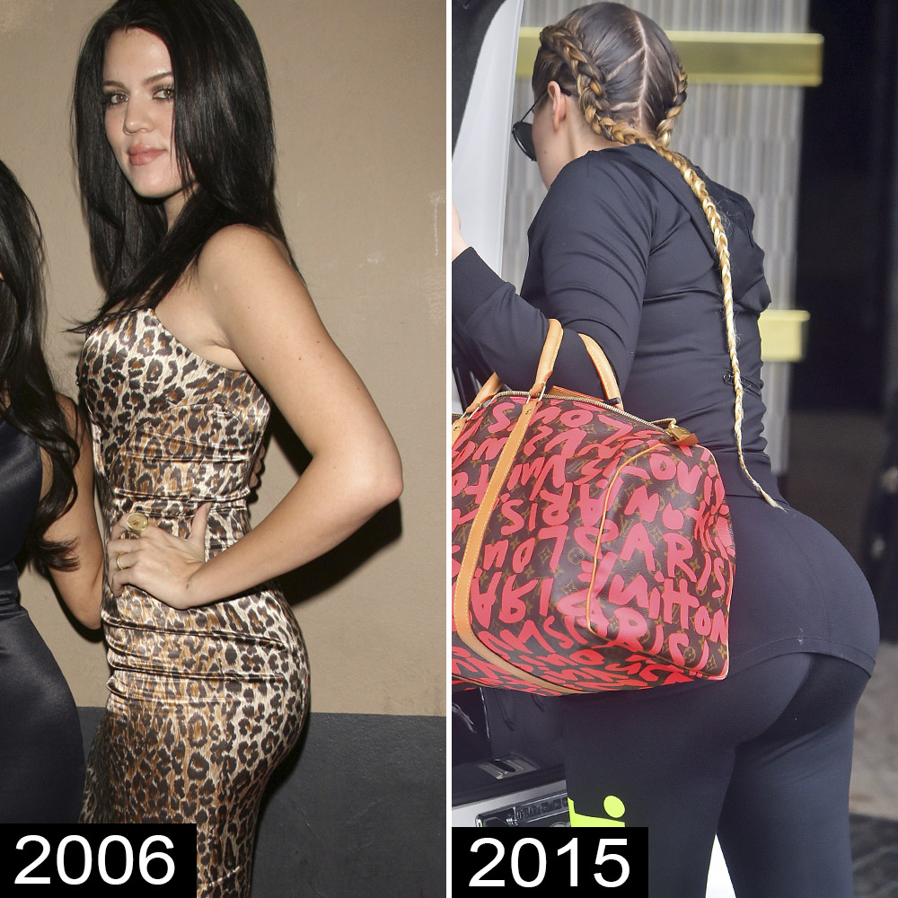 Khloé Kardashian accused of having butt implants