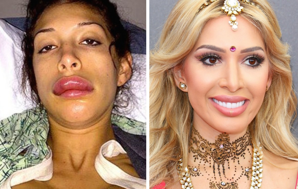 Teen Mom Stars Before And After Plastic Surgery