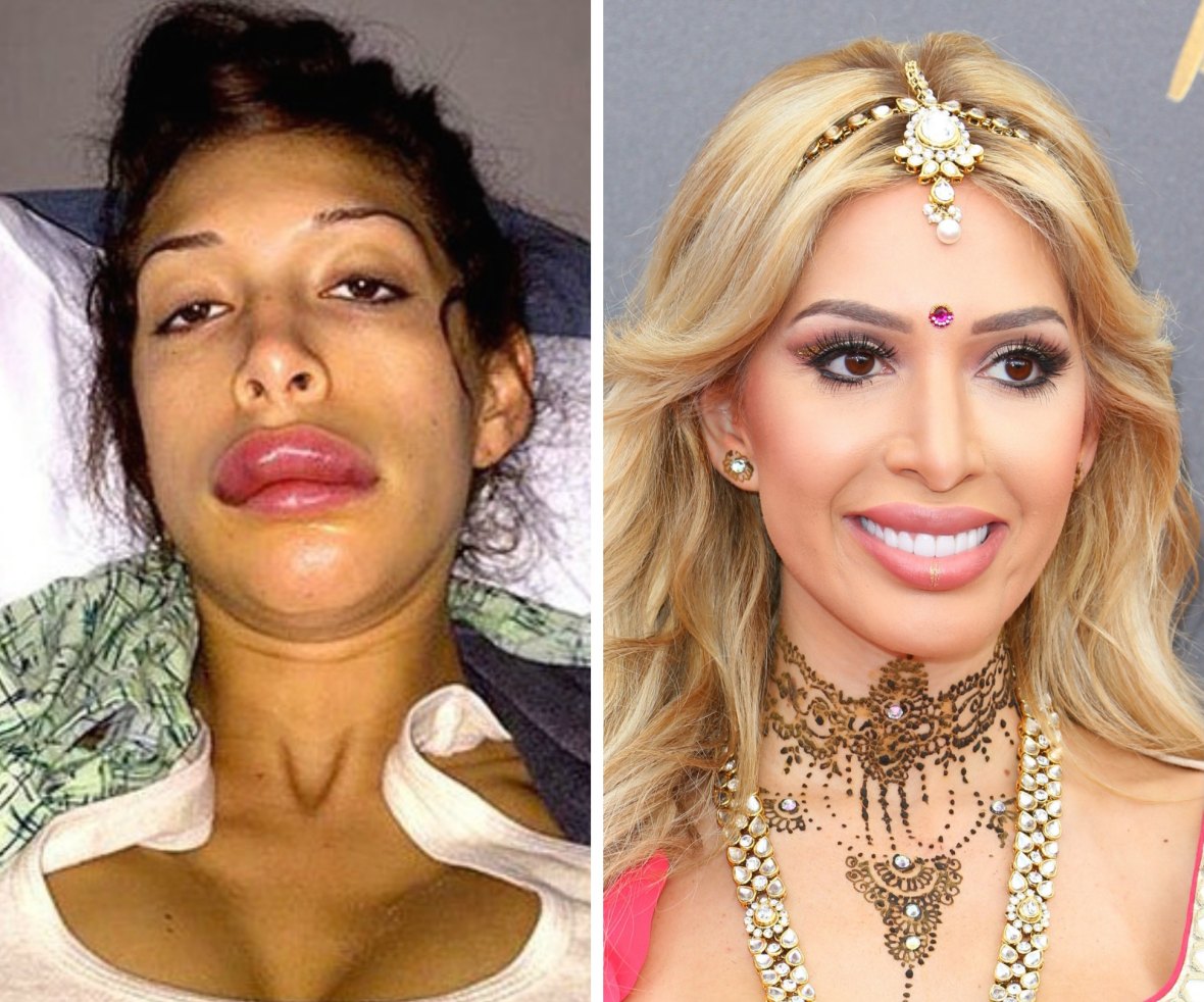 teen mom stars plastic surgery