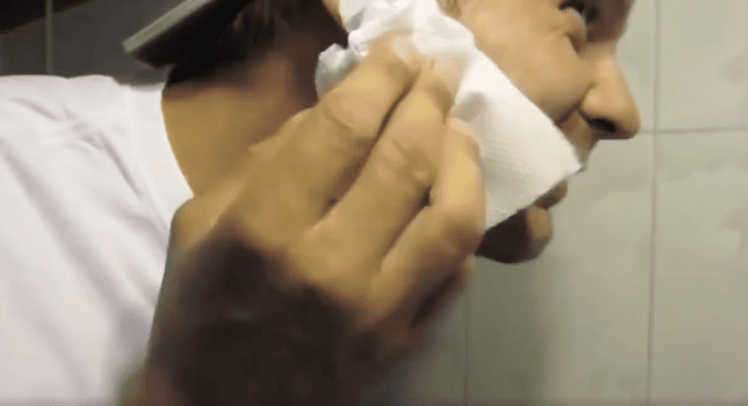 pimple popping video