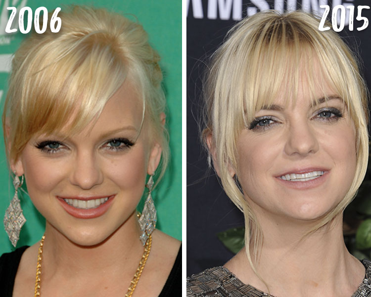 Anna Faris: Breast Implants and a Makeover Have Transformed Her