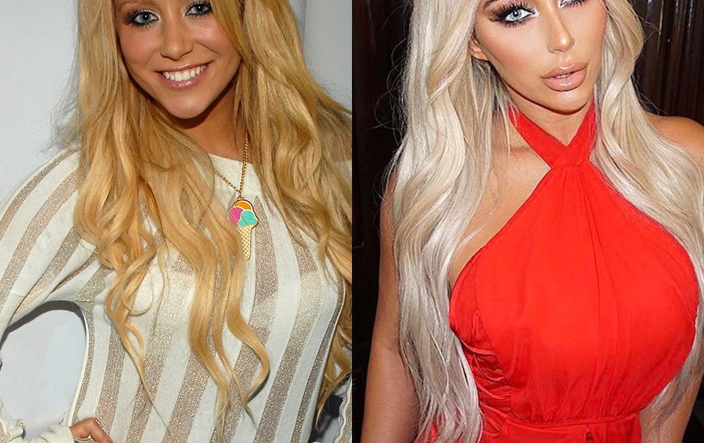 Aubrey O Day Before And After Did The Star Have Plastic Surgery