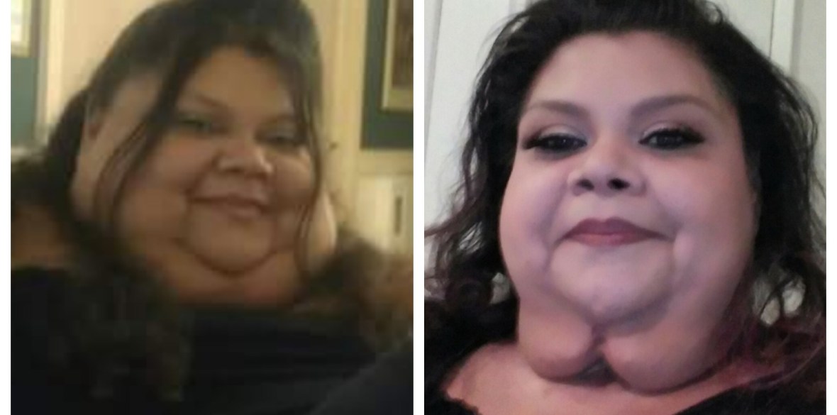 20 Incredible Before And After Photos From My 600 Lb - vrogue.co