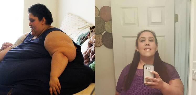 betti jo before and after