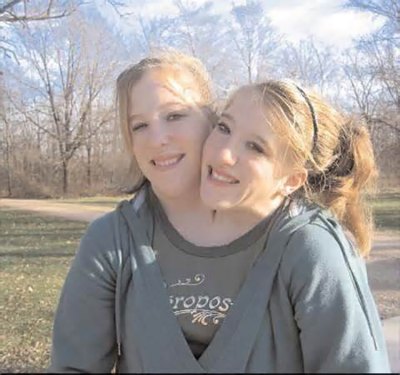 Conjoined twins Abigail and Brittany Hensel offer a glimpse in to