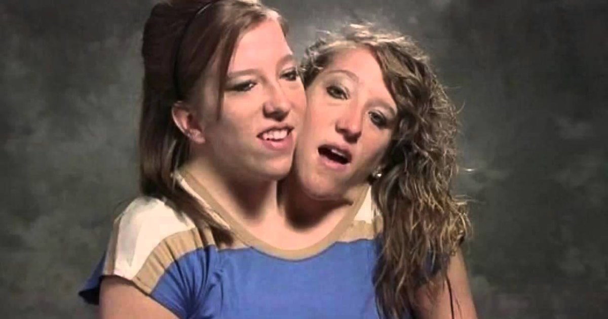 Real or Fake? 👇👇👇 . Abby and Brittany Hensel are conjoined twins. The  two became household names after they let the media into their…