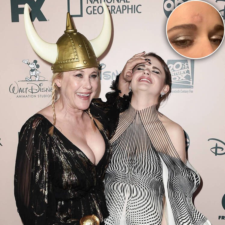 Patricia Arquette Accidentally Hit Joey King With Her Golden Globe