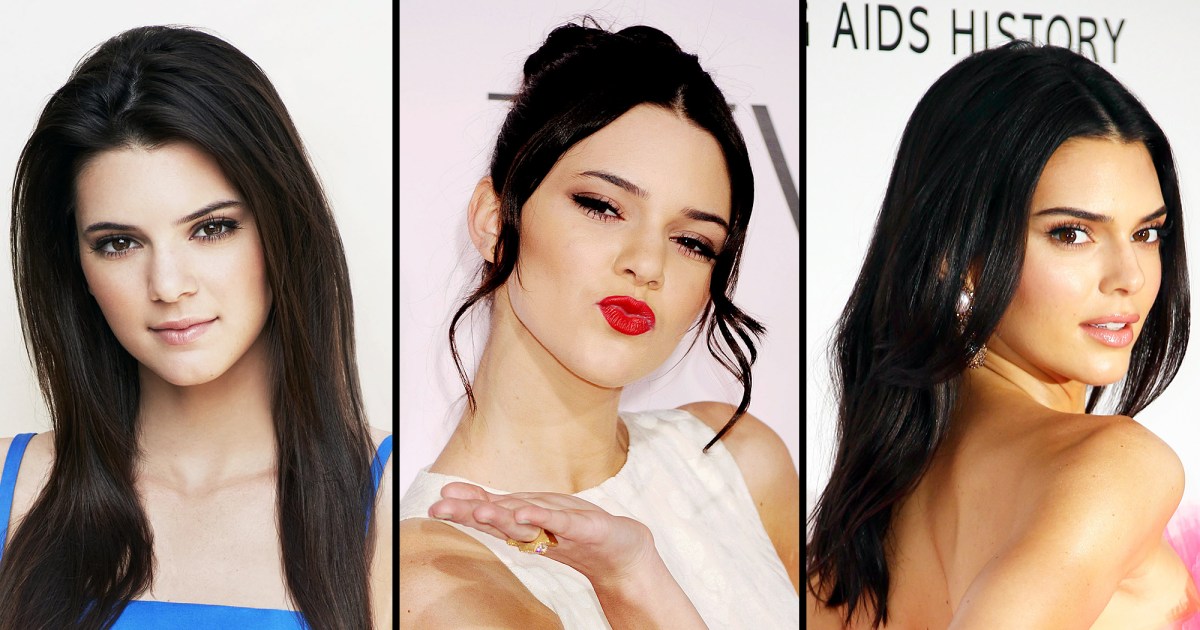 Kendall Jenners Transformation See Photos Then And Now