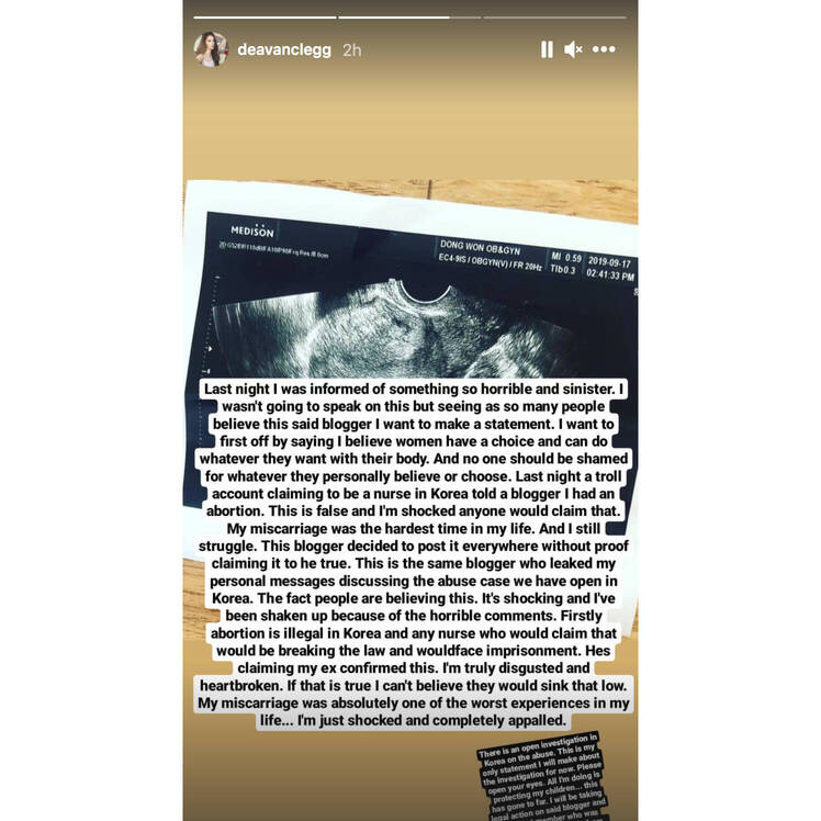 90 Day Fiance's Deavan Clegg Shuts Down Rumors She Had an Abortion