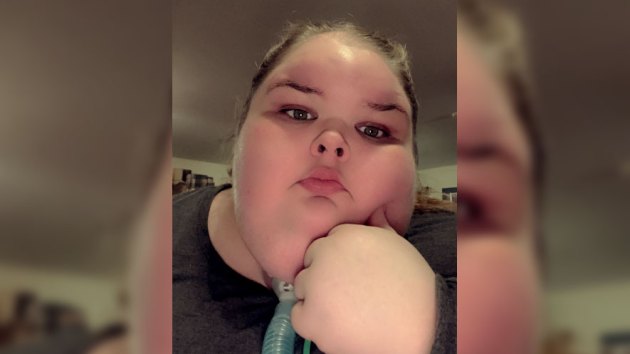 1000 Lb Sisters Tammy Shares Selfies After 115 Lb Weight Loss In Touch Weekly 