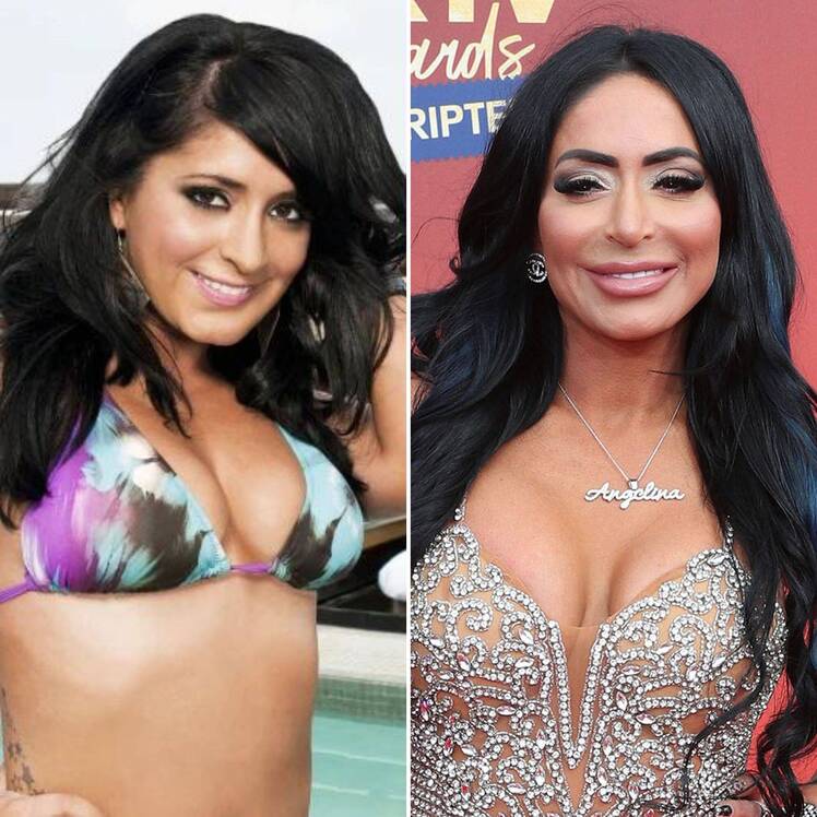Jersey Shore's Angelina Pivarnick Has Been Open About Plastic Surgery: See Before and After Photos