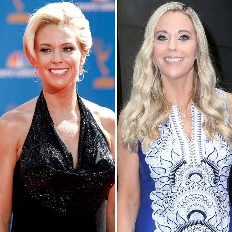 Kate Gosselin Plastic Surgery Speculation Transformation
