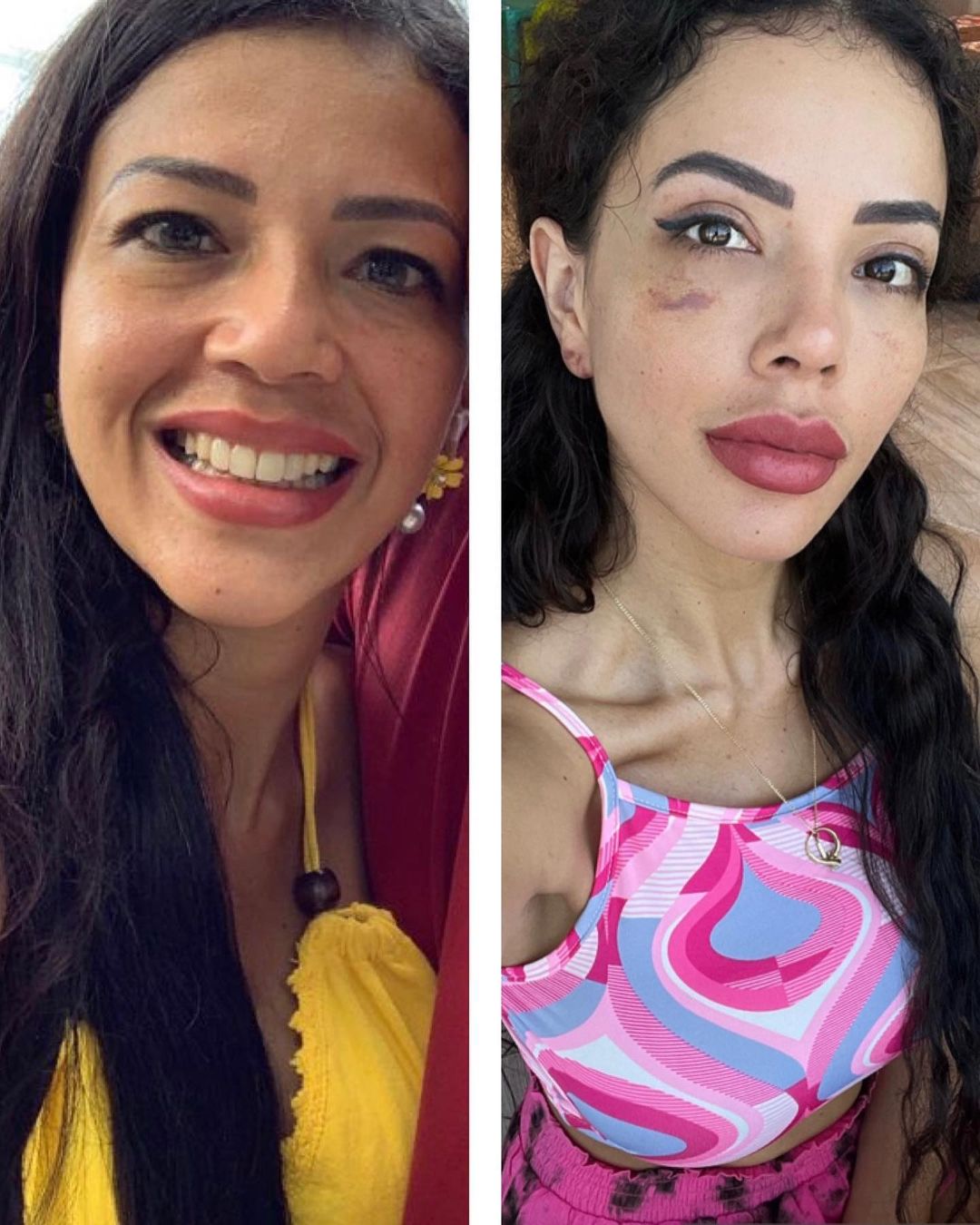 ‘90 Day Fiance Jasmine Pineda Plastic Surgery Photos In Touch Weekly 