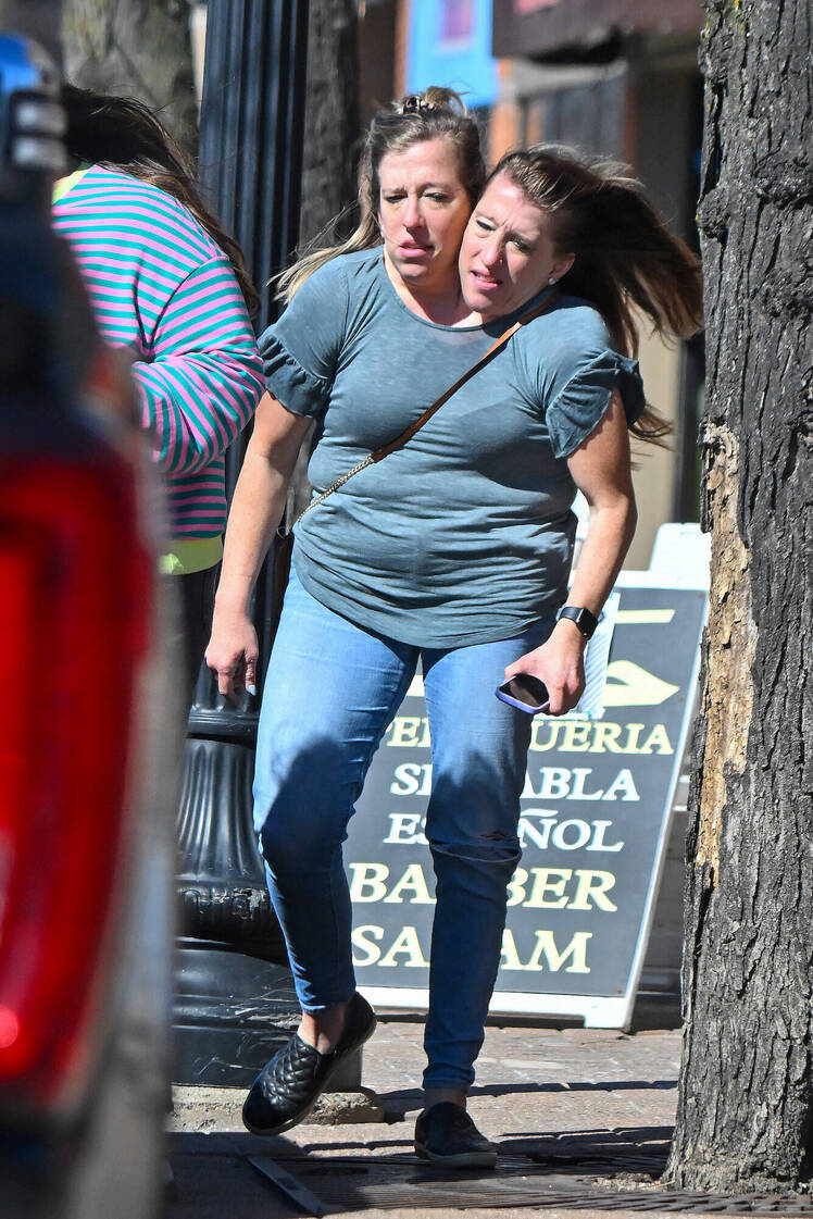 FEATURE Rare Photos of Conjoined Twins Abby and Brittany Hensel